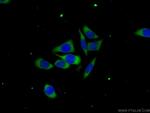 C6orf130 Antibody in Immunocytochemistry (ICC/IF)