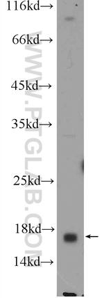 C6orf130 Antibody in Western Blot (WB)