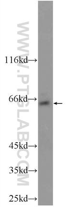 TBC1D24 Antibody in Western Blot (WB)