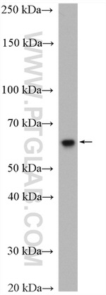 TBC1D24 Antibody in Western Blot (WB)