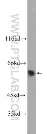 UAP1L1 Antibody in Western Blot (WB)