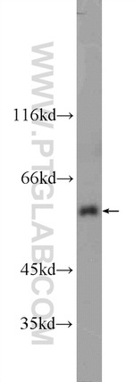 UAP1L1 Antibody in Western Blot (WB)