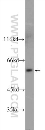 UAP1L1 Antibody in Western Blot (WB)