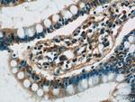 GPR44 Antibody in Immunohistochemistry (Paraffin) (IHC (P))