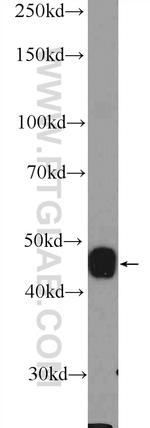 CRHR2 Antibody in Western Blot (WB)