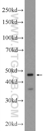 CRHR2 Antibody in Western Blot (WB)