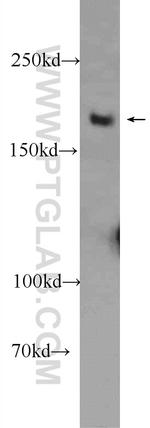 WRN Antibody in Western Blot (WB)