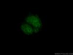 PHOX2B Antibody in Immunocytochemistry (ICC/IF)