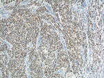 PHOX2B Antibody in Immunohistochemistry (Paraffin) (IHC (P))