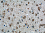 PHOX2B Antibody in Immunohistochemistry (Paraffin) (IHC (P))