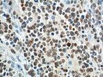 PHOX2B Antibody in Immunohistochemistry (Paraffin) (IHC (P))