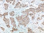 Integrin beta-4 Antibody in Immunohistochemistry (Paraffin) (IHC (P))