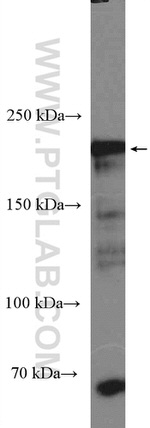 Integrin beta-4 Antibody in Western Blot (WB)