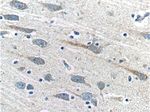 PRTN3 Antibody in Immunohistochemistry (Paraffin) (IHC (P))