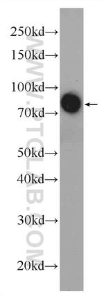 AFM Antibody in Western Blot (WB)