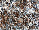 CCL25/TECK Antibody in Immunohistochemistry (Paraffin) (IHC (P))