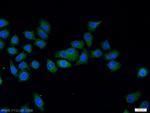 FER Antibody in Immunocytochemistry (ICC/IF)