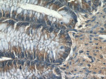 FER Antibody in Immunohistochemistry (Paraffin) (IHC (P))