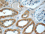 FER Antibody in Immunohistochemistry (Paraffin) (IHC (P))