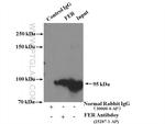 FER Antibody in Immunoprecipitation (IP)