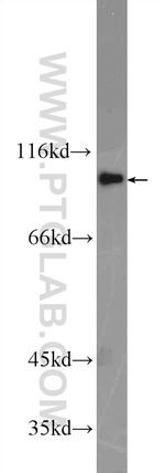 FER Antibody in Western Blot (WB)