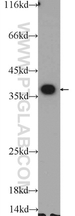 EXOSC7 Antibody in Western Blot (WB)