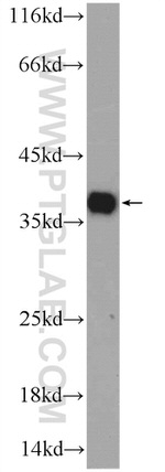 EXOSC7 Antibody in Western Blot (WB)