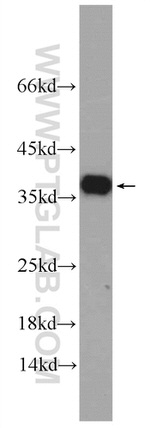 EXOSC7 Antibody in Western Blot (WB)