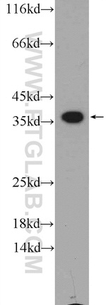 EXOSC7 Antibody in Western Blot (WB)