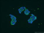 EPRS Antibody in Immunocytochemistry (ICC/IF)