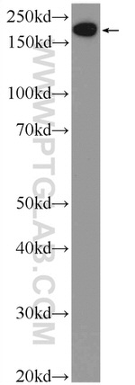 EPRS Antibody in Western Blot (WB)