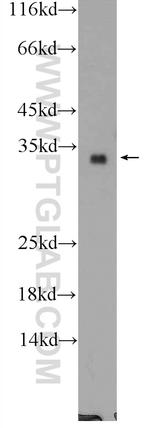 FGF17 Antibody in Western Blot (WB)