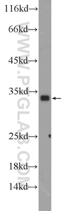 FGF17 Antibody in Western Blot (WB)