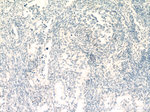 RUNX1 (middle) Antibody in Immunohistochemistry (Paraffin) (IHC (P))