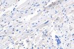 Desmoplakin Antibody in Immunohistochemistry (Paraffin) (IHC (P))