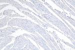 Desmoplakin Antibody in Immunohistochemistry (Paraffin) (IHC (P))