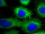 Desmoplakin Antibody in Immunocytochemistry (ICC/IF)