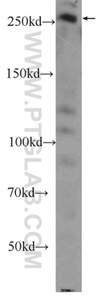 Desmoplakin Antibody in Western Blot (WB)