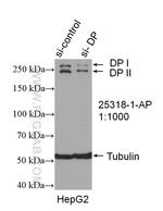 Desmoplakin Antibody in Western Blot (WB)