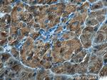 DYNC1LI1 Antibody in Immunohistochemistry (Paraffin) (IHC (P))