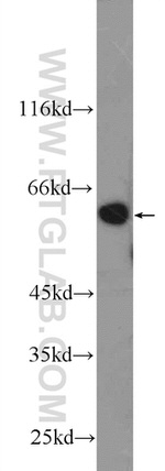 DYNC1LI1 Antibody in Western Blot (WB)