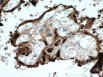 HSD17B1 Antibody in Immunohistochemistry (Paraffin) (IHC (P))