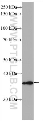 HSD17B1 Antibody in Western Blot (WB)