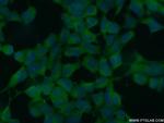 CHD3 Antibody in Immunocytochemistry (ICC/IF)