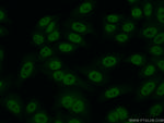 RTEL1 Antibody in Immunocytochemistry (ICC/IF)