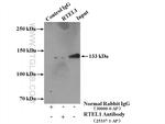 RTEL1 Antibody in Immunoprecipitation (IP)