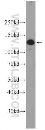 RTEL1 Antibody in Western Blot (WB)