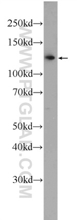 RTEL1 Antibody in Western Blot (WB)