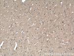 ABCA7 Antibody in Immunohistochemistry (Paraffin) (IHC (P))