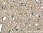 ABCA7 Antibody in Immunohistochemistry (Paraffin) (IHC (P))